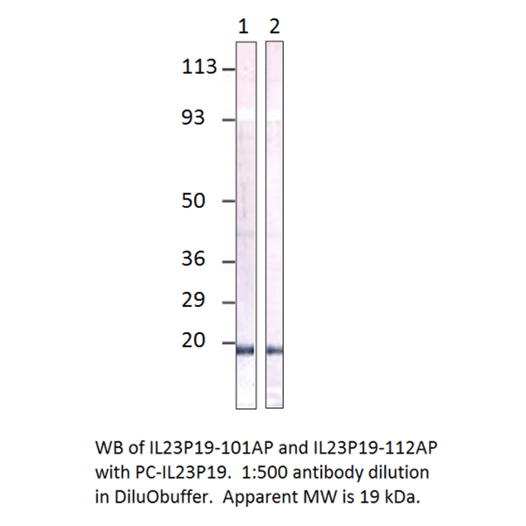 Anti-IL23 P19 Antibody from FabGennix (IL23P19-101AP) - Antibodies.com