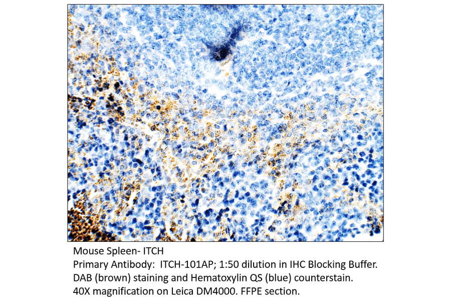 Anti-ITCH / AIP4 Antibody from FabGennix (ITCH-101AP) - Antibodies.com
