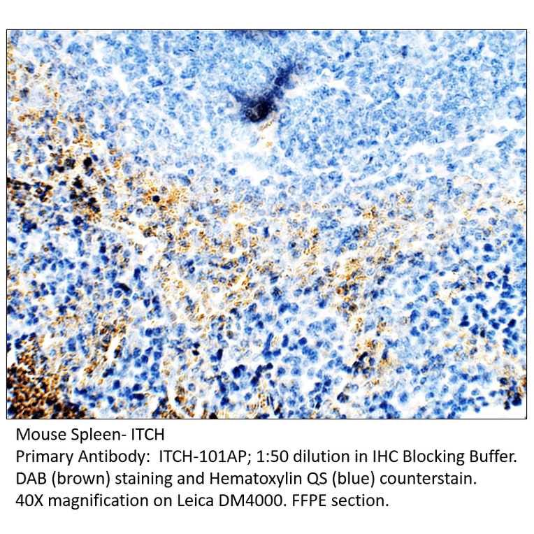 Anti-ITCH / AIP4 Antibody from FabGennix (ITCH-101AP) - Antibodies.com