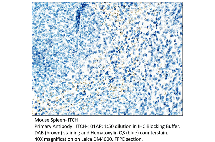 Anti-ITCH / AIP4 Antibody from FabGennix (ITCH-101AP) - Antibodies.com
