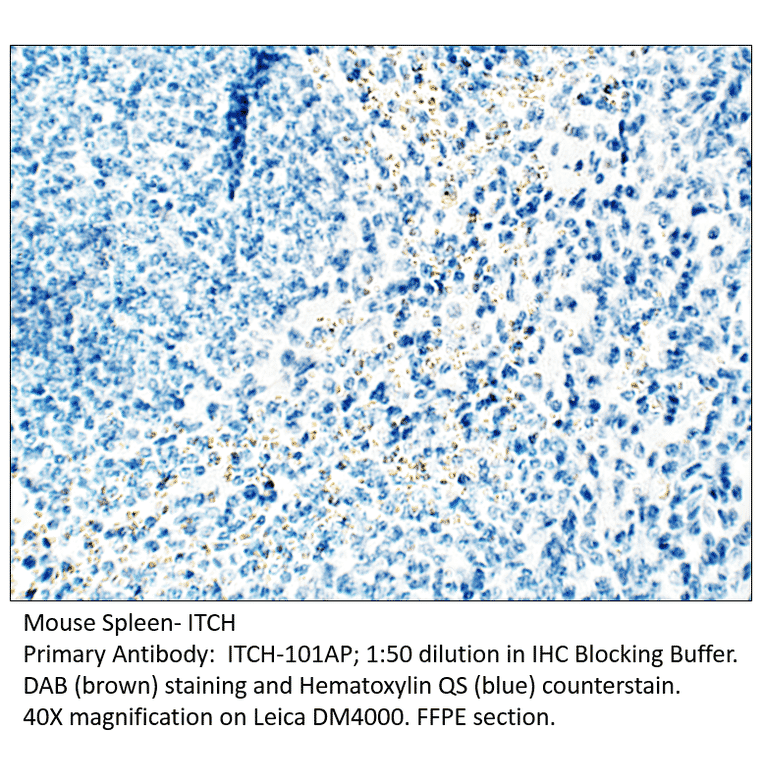 Anti-ITCH / AIP4 Antibody from FabGennix (ITCH-101AP) - Antibodies.com