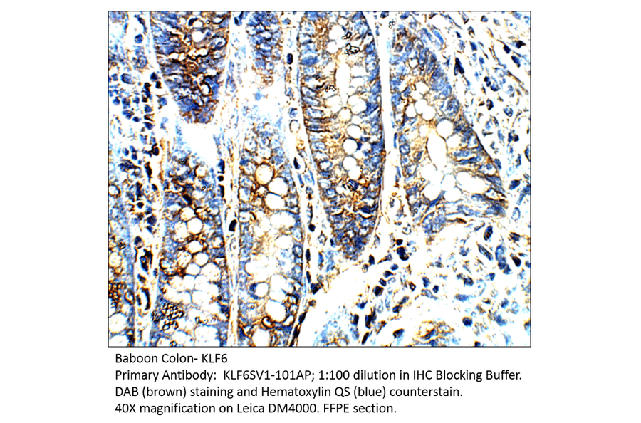 Anti-KLF6 SV1 Antibody from FabGennix (KLF6SV1-101AP) - Antibodies.com