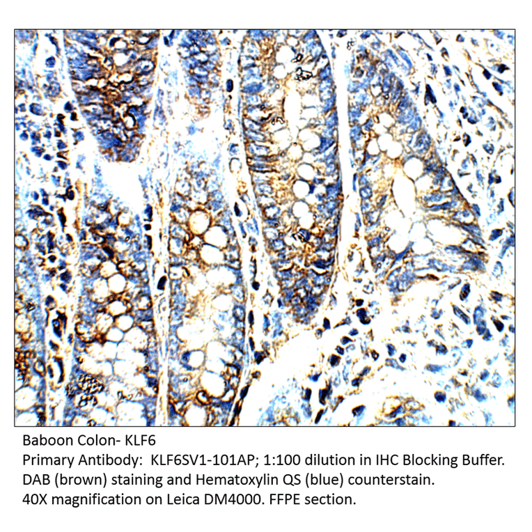 Anti-KLF6 SV1 Antibody from FabGennix (KLF6SV1-101AP) - Antibodies.com