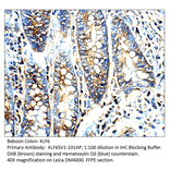 Anti-KLF6 SV1 Antibody from FabGennix (KLF6SV1-101AP) - Antibodies.com