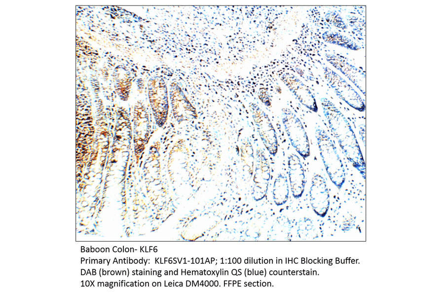 Anti-KLF6 SV1 Antibody from FabGennix (KLF6SV1-101AP) - Antibodies.com