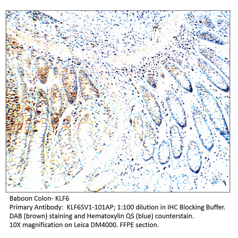 Anti-KLF6 SV1 Antibody from FabGennix (KLF6SV1-101AP) - Antibodies.com