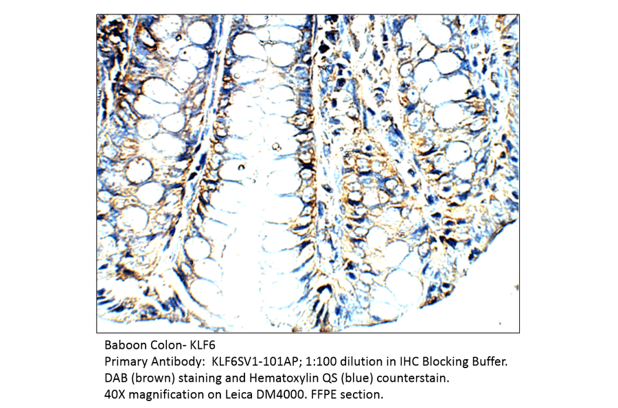 Anti-KLF6 SV1 Antibody from FabGennix (KLF6SV1-101AP) - Antibodies.com