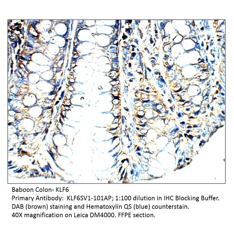 Anti-KLF6 SV1 Antibody from FabGennix (KLF6SV1-101AP) - Antibodies.com