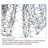 Anti-KLF6 SV1 Antibody from FabGennix (KLF6SV1-101AP) - Antibodies.com