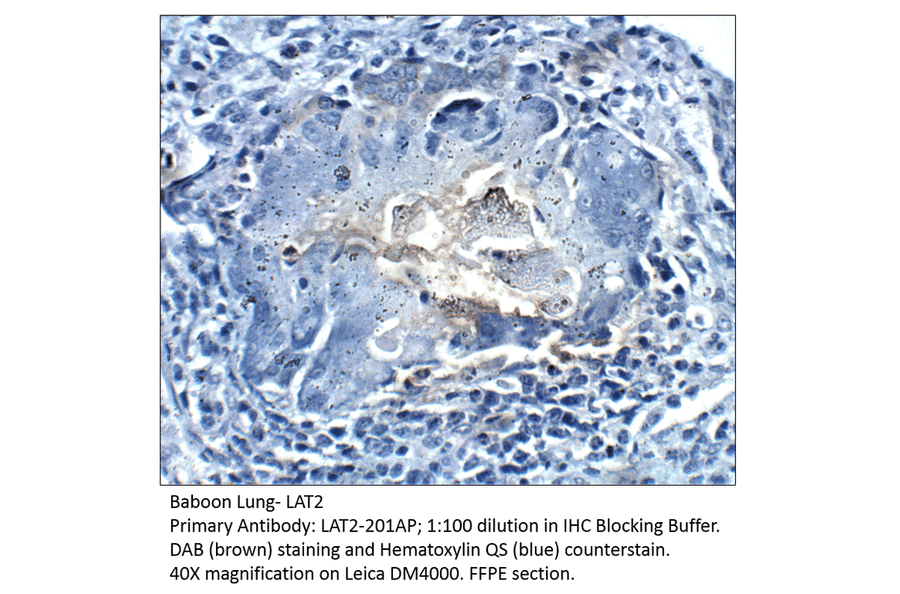 Anti-LAT2 / NTAL Antibody from FabGennix (LAT2-201AP) - Antibodies.com