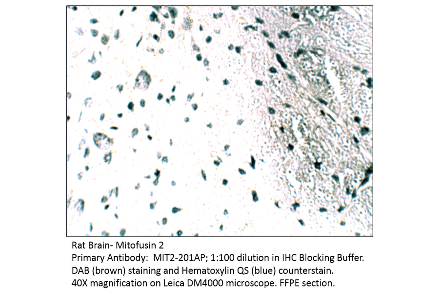 Anti-Mitofusin 2 Antibody from FabGennix (MIT2-201AP) - Antibodies.com