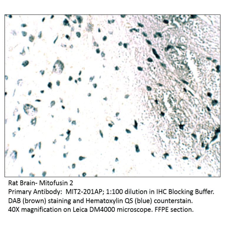 Anti-Mitofusin 2 Antibody from FabGennix (MIT2-201AP) - Antibodies.com