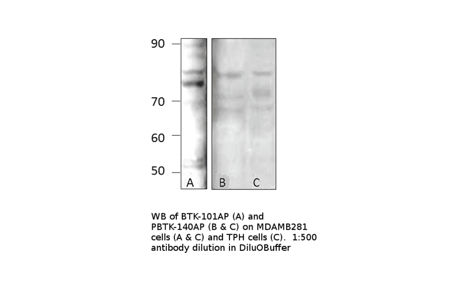 Anti-Phospho-BTK Antibody from FabGennix (PBTK-140AP) - Antibodies.com