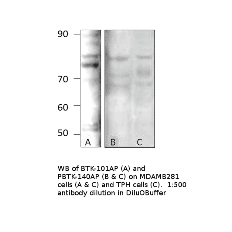Anti-Phospho-BTK Antibody from FabGennix (PBTK-140AP) - Antibodies.com