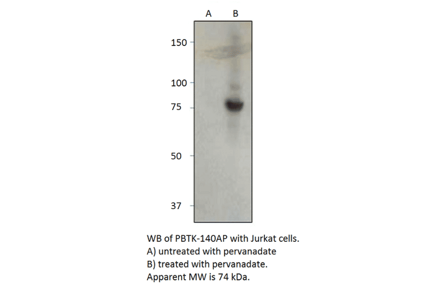 Anti-Phospho-BTK Antibody from FabGennix (PBTK-140AP) - Antibodies.com
