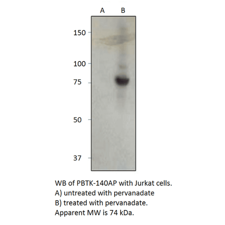 Anti-Phospho-BTK Antibody from FabGennix (PBTK-140AP) - Antibodies.com