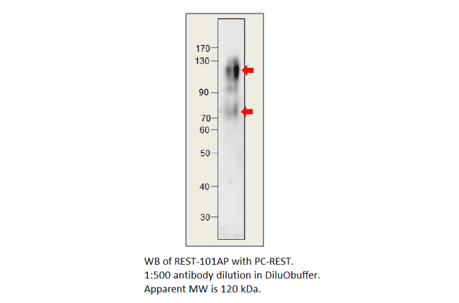 Anti-REST / NRSF Antibody from FabGennix (REST-101AP) - Antibodies.com