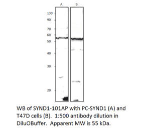 Anti-Syndecan-1 Antibody from FabGennix (SYND1-101AP) - Antibodies.com