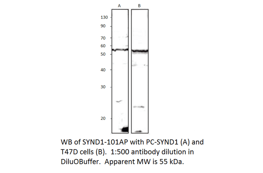 Anti-Syndecan-1 Antibody from FabGennix (SYND1-101AP) - Antibodies.com