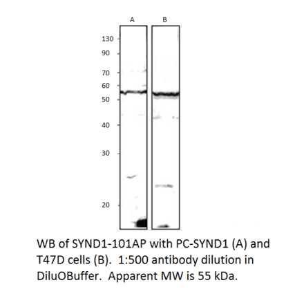 Anti-Syndecan-1 Antibody from FabGennix (SYND1-101AP) - Antibodies.com