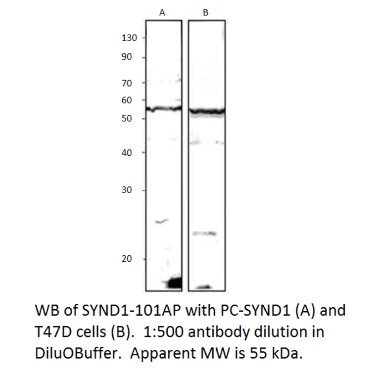 Anti-Syndecan-1 Antibody from FabGennix (SYND1-101AP) - Antibodies.com