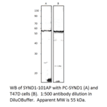 Anti-Syndecan-1 Antibody from FabGennix (SYND1-101AP) - Antibodies.com
