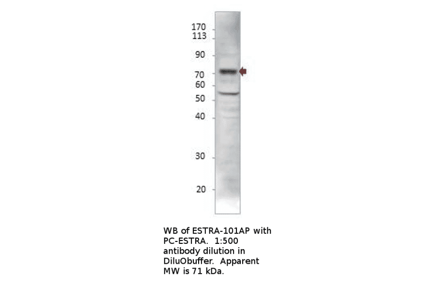 Anti-Estrogen Receptor alpha Antibody from FabGennix (ESTRA-101AP) - Antibodies.com