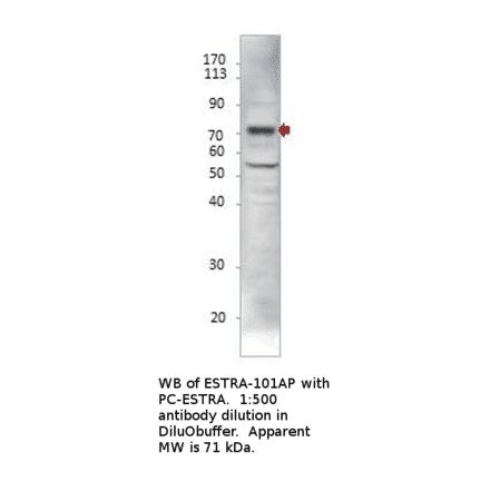 Anti-Estrogen Receptor alpha Antibody from FabGennix (ESTRA-101AP) - Antibodies.com
