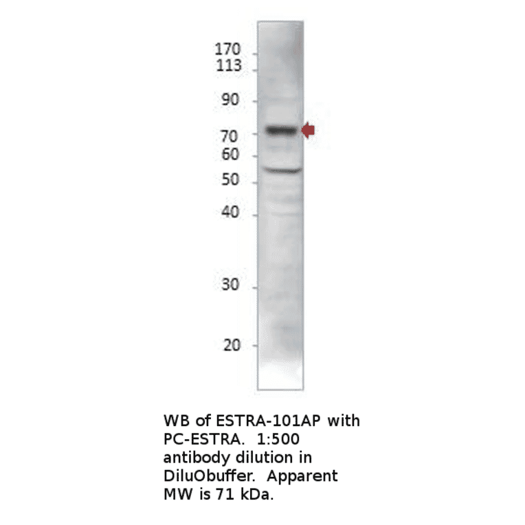 Anti-Estrogen Receptor alpha Antibody from FabGennix (ESTRA-101AP) - Antibodies.com