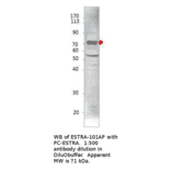Anti-Estrogen Receptor alpha Antibody from FabGennix (ESTRA-101AP) - Antibodies.com