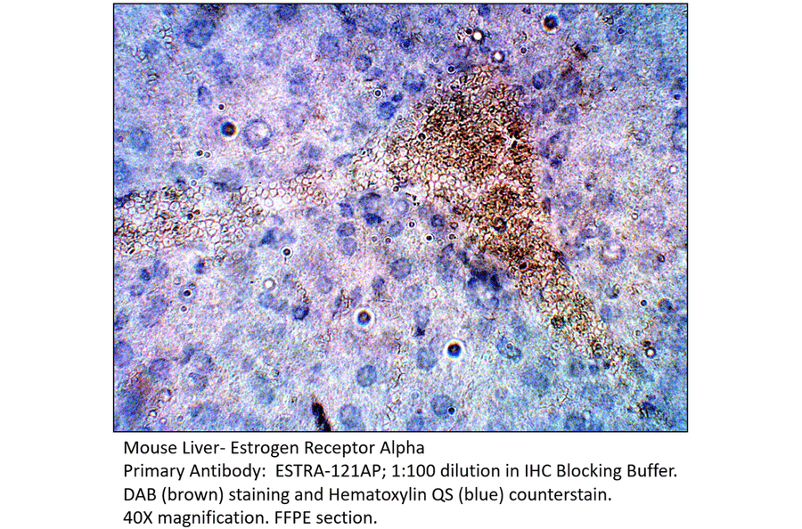 Anti-Estrogen Receptor alpha Antibody from FabGennix (ESTRA-121AP) - Antibodies.com