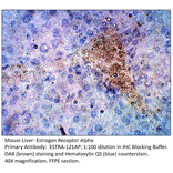 Anti-Estrogen Receptor alpha Antibody from FabGennix (ESTRA-121AP) - Antibodies.com