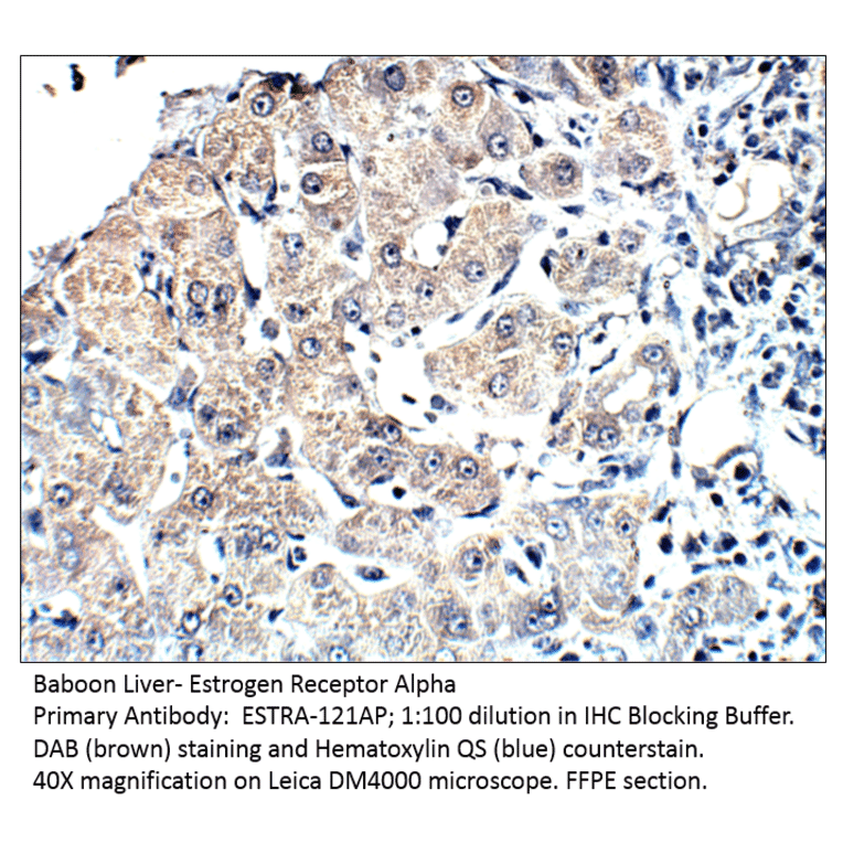 Anti-Estrogen Receptor alpha Antibody from FabGennix (ESTRA-121AP) - Antibodies.com