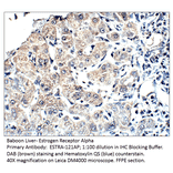 Anti-Estrogen Receptor alpha Antibody from FabGennix (ESTRA-121AP) - Antibodies.com