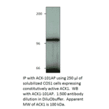 Anti-ACK1 Antibody (FITC) from FabGennix (ACK1-FITC) - Antibodies.com