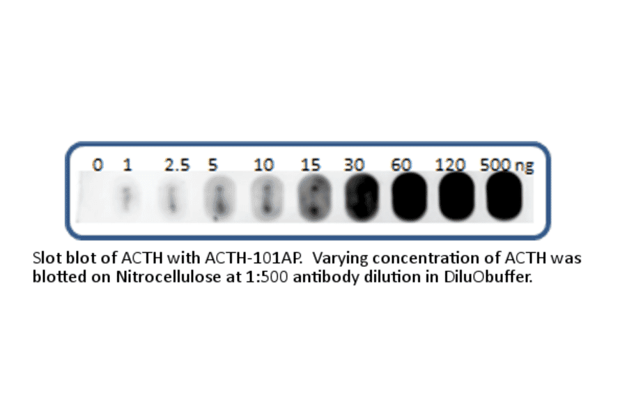 Anti-ACTH Antibody (FITC) from FabGennix (ACTH-FITC) - Antibodies.com