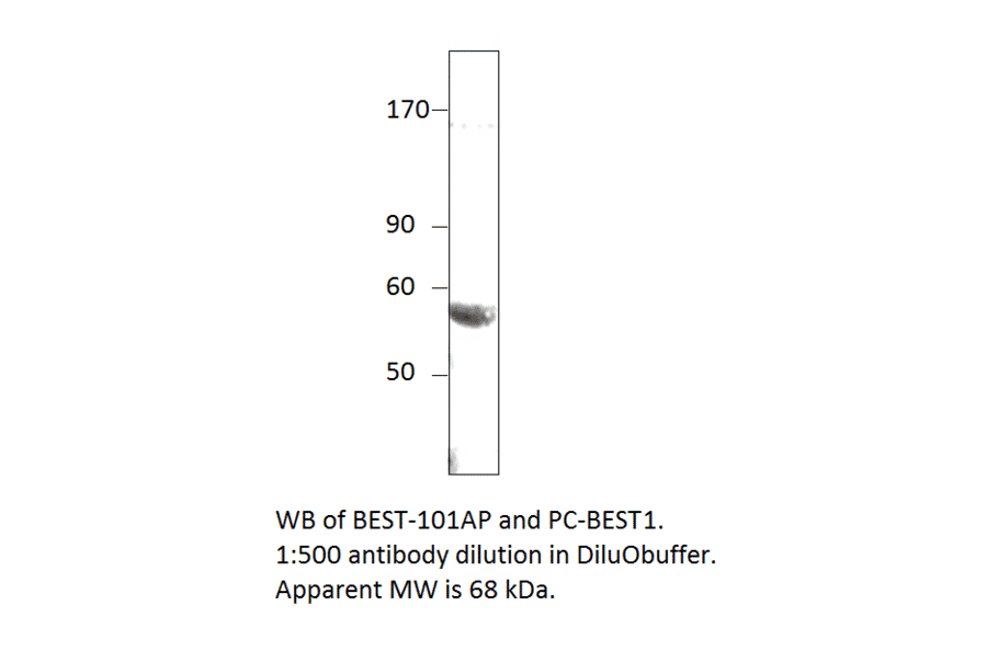 Anti-Bestrophin Antibody from FabGennix (BEST-101AP) - Antibodies.com