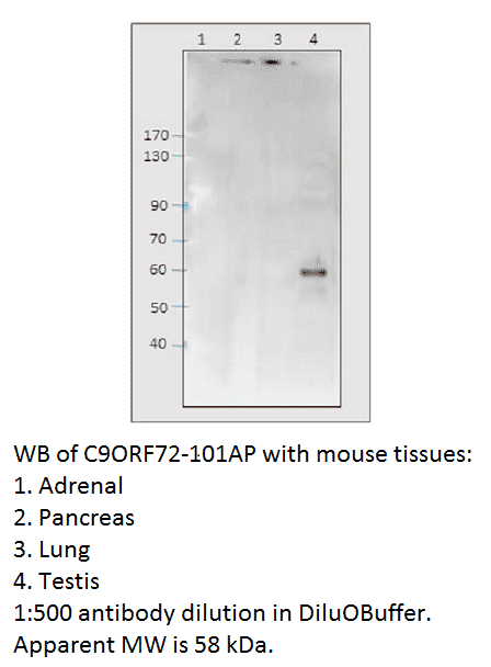 Anti-C9orf72 Antibody