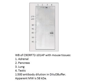 Anti-C9orf72 Antibody from FabGennix (C9ORF72-101AP) - Antibodies.com
