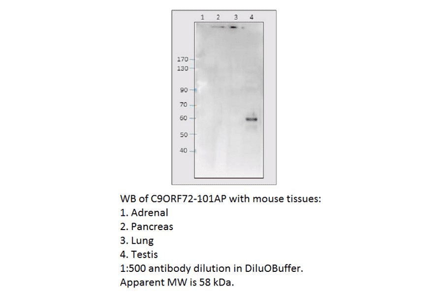Anti-C9orf72 Antibody from FabGennix (C9ORF72-101AP) - Antibodies.com