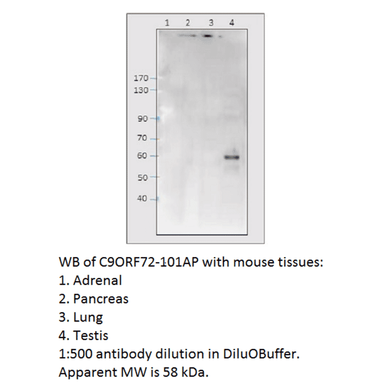 Anti-C9orf72 Antibody from FabGennix (C9ORF72-101AP) - Antibodies.com