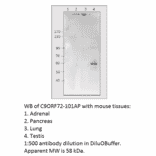 Anti-C9orf72 Antibody from FabGennix (C9ORF72-101AP) - Antibodies.com