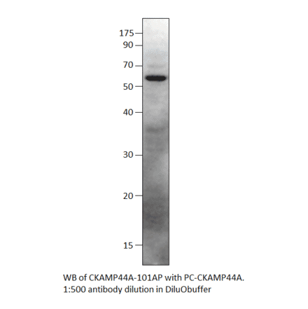 Anti-SHISA9 Antibody from FabGennix (CKAMP44A-101AP) - Antibodies.com