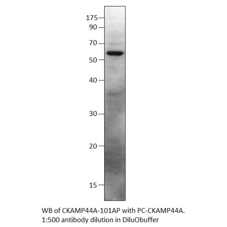 Anti-SHISA9 Antibody from FabGennix (CKAMP44A-101AP) - Antibodies.com