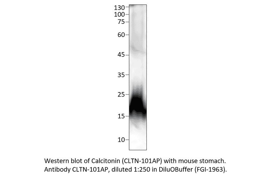 Anti-Calcitonin Antibody from FabGennix (CLTN-101AP) - Antibodies.com