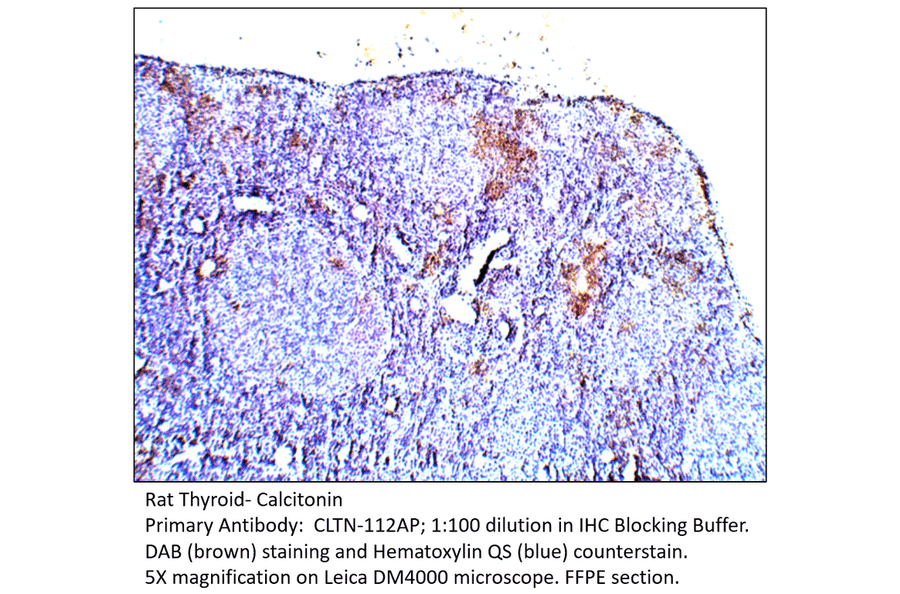 Anti-Calcitonin Antibody from FabGennix (CLTN-112AP) - Antibodies.com