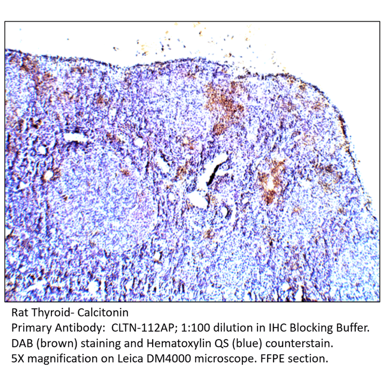 Anti-Calcitonin Antibody from FabGennix (CLTN-112AP) - Antibodies.com