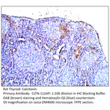 Anti-Calcitonin Antibody from FabGennix (CLTN-112AP) - Antibodies.com