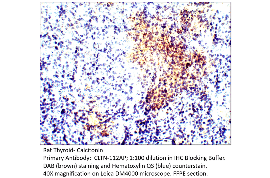 Anti-Calcitonin Antibody from FabGennix (CLTN-112AP) - Antibodies.com