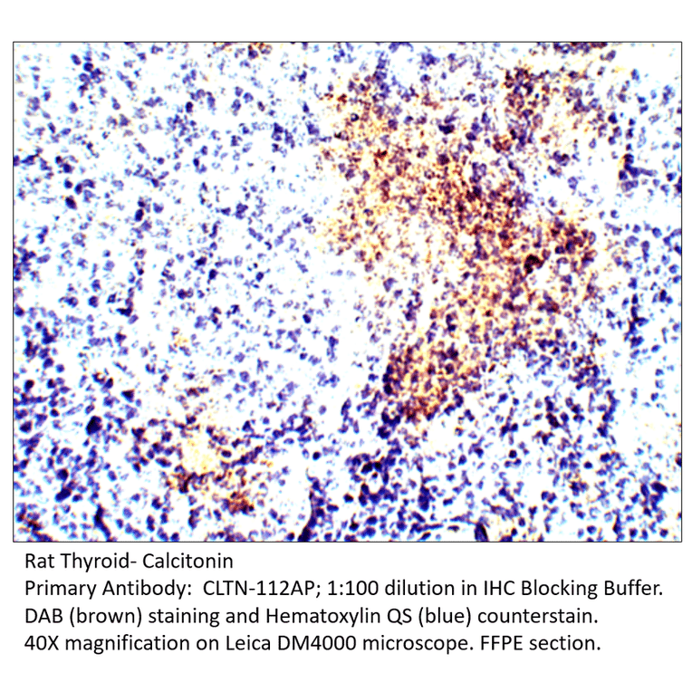 Anti-Calcitonin Antibody from FabGennix (CLTN-112AP) - Antibodies.com